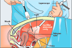 anatomic anatomic